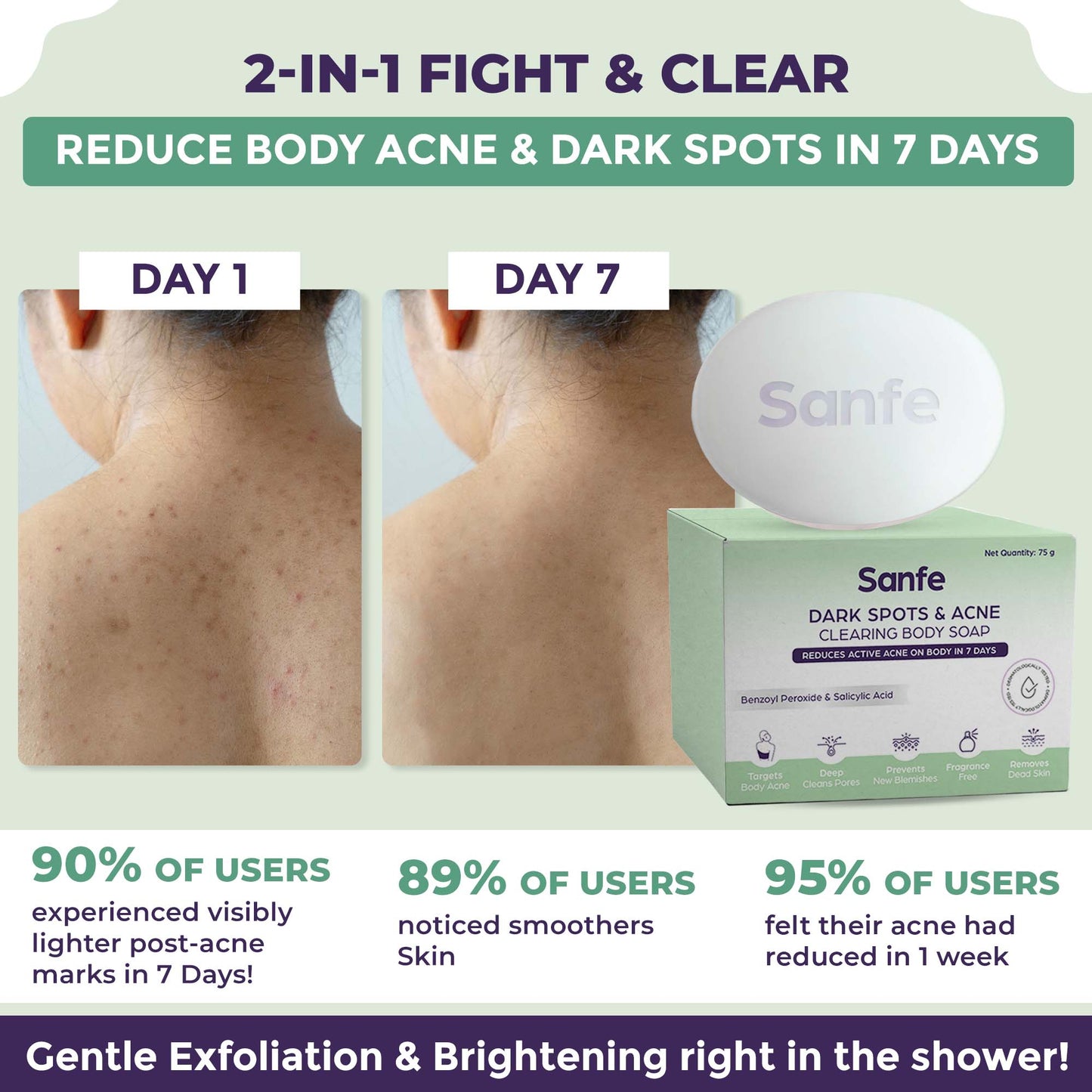 Acne Clearing Soap