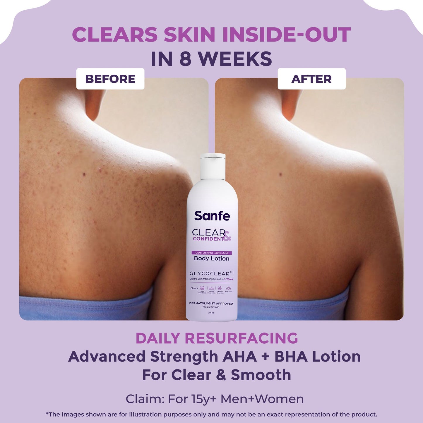 Sanfe Glycolic Acid Body Lotion