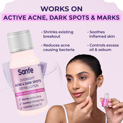 Sanfe Overnight Acne  Dark Spots Drying Lotion - 10ml