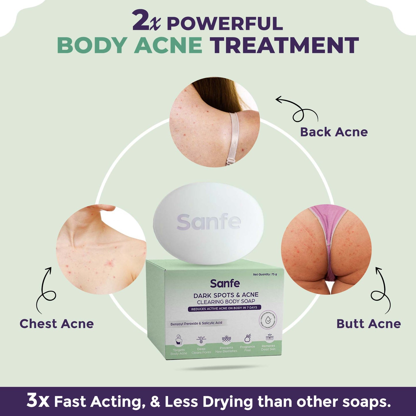 Sanfe Acne Clearing Soap