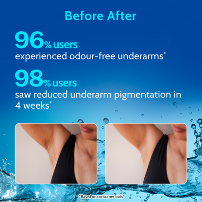 Underarm Roll On for Odour Control  Pigmentation