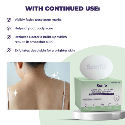 Sanfe Dark Spot Acne Clearing Soap