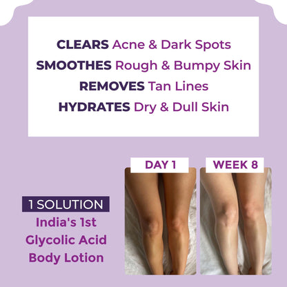 Sanfe Glycolic Acid Body Lotion