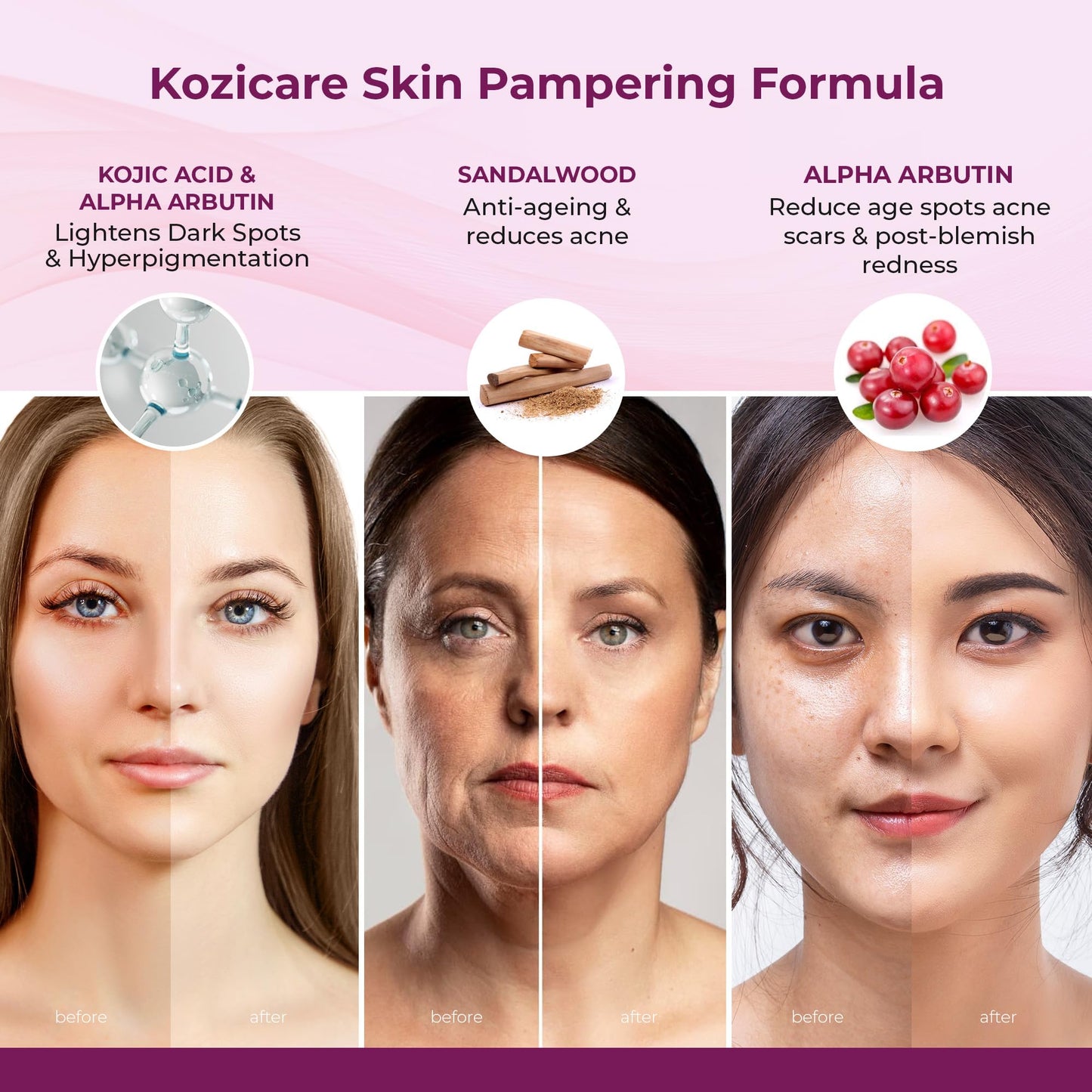 Kozicare Cream For Dry Skin  Kojic Acid Cream  Tan Removal Cream Sandalwood Face Cream For Women  Moisturizer For Dry Skin  Skin Brightening Cream - 15 gm