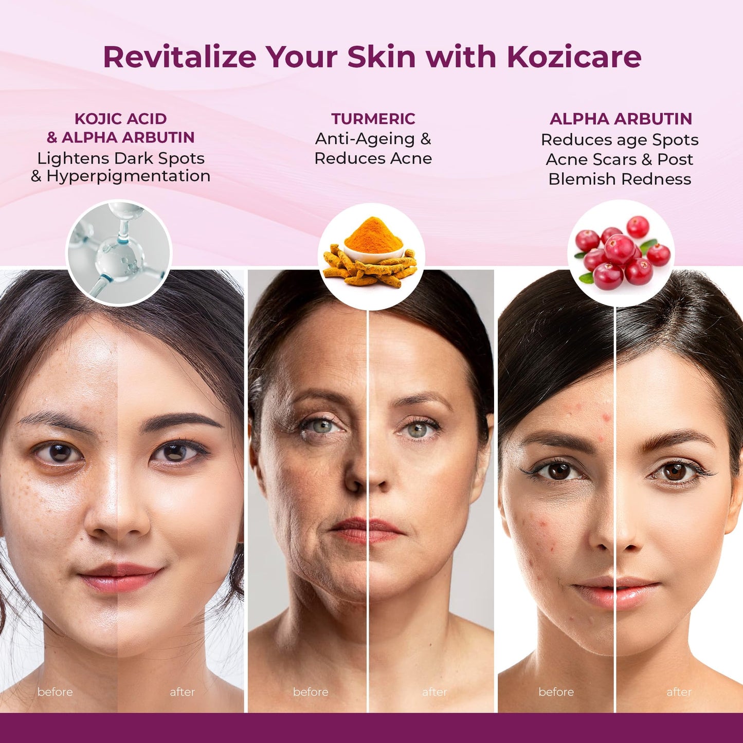 Kozicare Kojic Acid Skin Whitening Cream, Turmeric, Glutathione, Detan, Moisturizer for Dry Skin, Summer Daily Use, Women & Men - 15gm