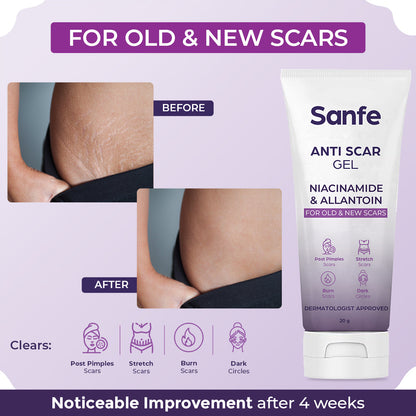 Sanfe Anti Scar Gel - 20g