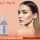 Urban Yog Face Care Combo Kit- Anti-Pigmentation Serum 30 ml and Acne Pimple Patch 72 Dots for and Clear Skin with 100 Hydrocolloid 10 Niacinamide  For acne and dark spots  For all skin types
